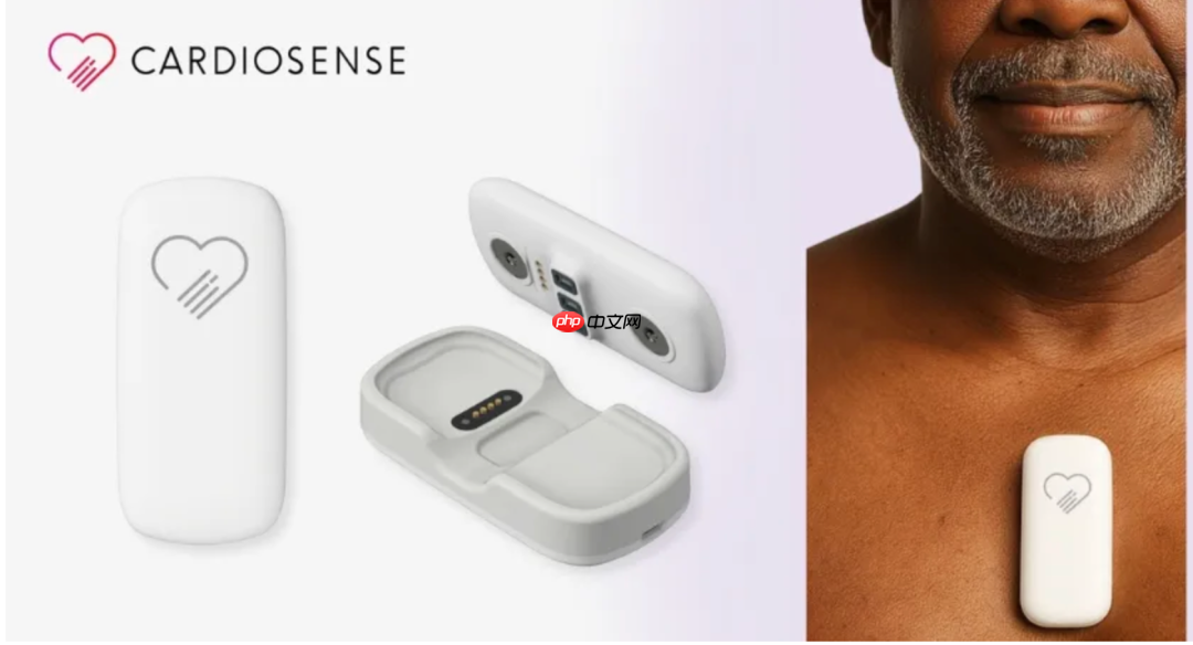 创新医疗新参数-SCG（心震图）：详细解读版