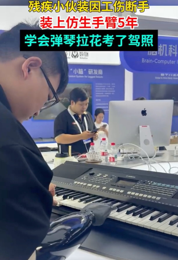 00后独臂小伙装仿生手考下驾照是怎么回事？详情介绍