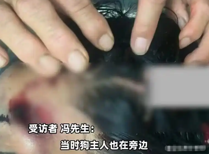 悲剧!河北女子骑车被狗撞倒身亡,主人为躲赔偿将狗打死 - php中文网