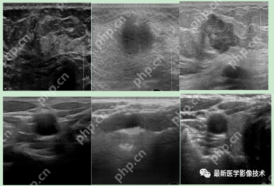 USenhance2023——2023 年超声图像增强挑战赛